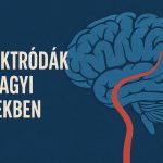 Elektródák az agyi erekben